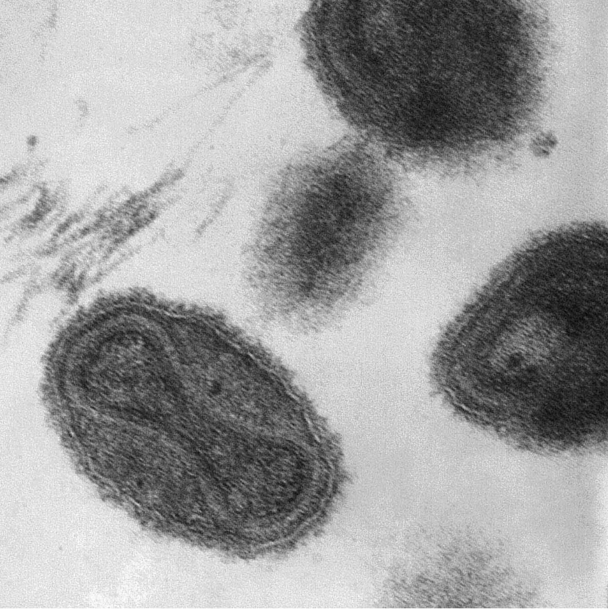 Smallpox virus viewed through electron microscopy